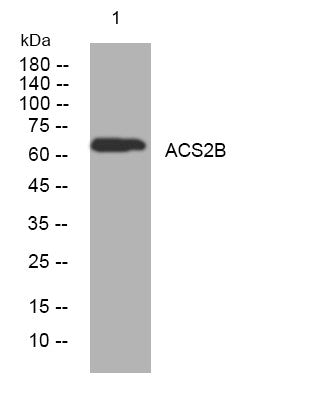 Anti-ACSM2B antibody (264-314 aa) (STJ195962) – Figure 1 of 1