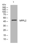Anti-NPIPB15 antibody (312-362 aa) (STJ195974) – Figure 1 of 1