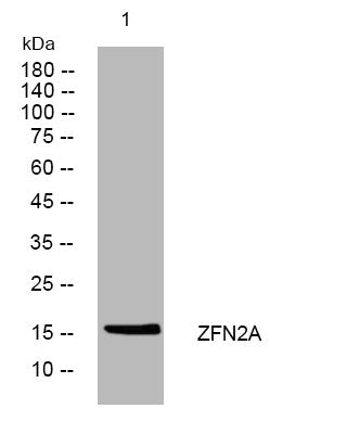 Anti-ZFAND2A antibody (42-92 aa) (STJ195986) – Figure 1 of 1