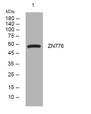 Anti-ZNF776 antibody (276-326 aa) (STJ195988) – Figure 1 of 1