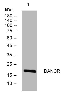 Anti-DANCR antibody (52-102 aa) (STJ196000) – Figure 1 of 1