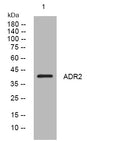 Anti-ADIPOR2 antibody (62-112 aa) (STJ196023) – Figure 1 of 1