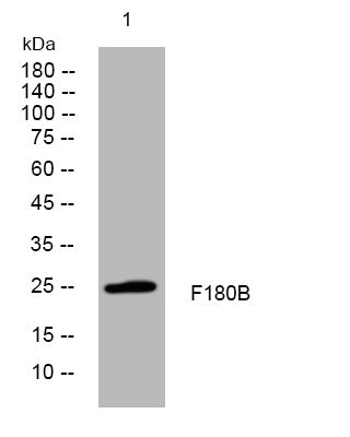 Anti-FAM180B antibody (8-58 aa) (STJ196048) – Figure 1 of 1