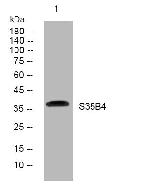 Anti-SLC35B4 antibody (193-243 aa) (STJ196066) – Figure 1 of 1