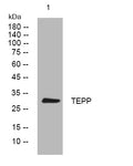 Anti-SPMIP8 antibody (24-74 aa) (STJ196070) – Figure 1 of 1