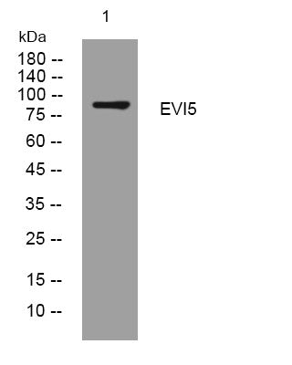Anti-EVI5 antibody (1-51 aa) (STJ196108) – Figure 1 of 1