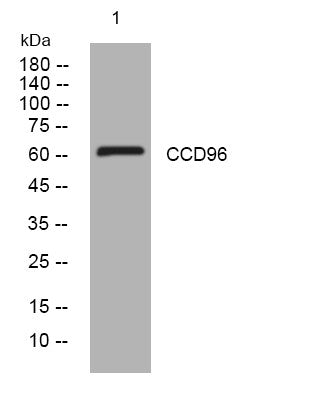 Anti-CCDC96 antibody (345-395 aa) (STJ196110) – Figure 1 of 1