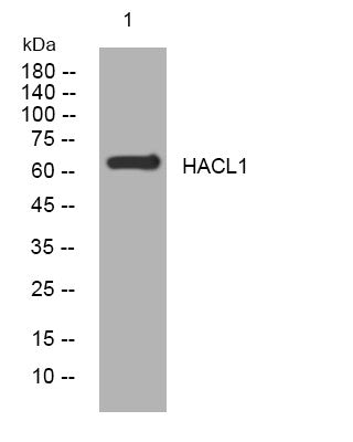 Anti-HACL1 antibody (323-373 aa) (STJ196113) – Figure 1 of 1