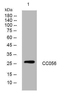 Anti-PRR23E antibody (186-236 aa) (STJ196134) – Figure 1 of 1