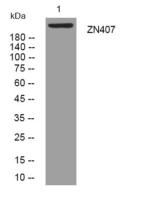 Anti-ZNF407 antibody (1144-1194 aa) (STJ196138) – Figure 1 of 1