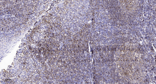 Anti-CLDN2 antibody (STJ196148) – Figure 1 of 1