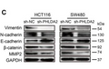Anti-YWHAH antibody (STJ196152) – Figure 1 of 1