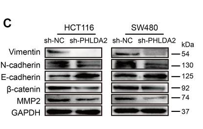 Anti-YWHAH antibody (STJ196152) – Figure 1 of 1