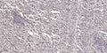 Anti-VIL1 antibody (STJ196153) – Figure 1 of 1