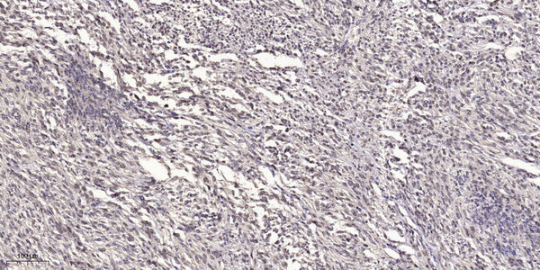 Anti-VIL1 antibody (STJ196153) – Figure 1 of 1