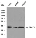 Anti-ERCC1 antibody (1-100 aa) (STJ196164) – Figure 1 of 1