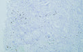 Anti-Mast Cell Tryptase antibody (200-275 aa) [PT2025] (STJ196170) – Figure 1 of 1