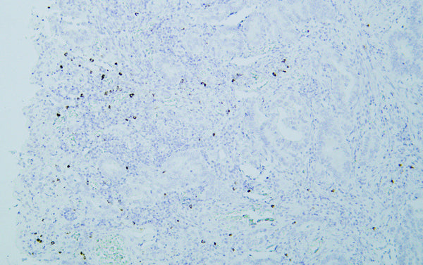 Anti-Mast Cell Tryptase antibody (200-275 aa) [PT2025] (STJ196170) – Figure 1 of 1