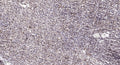 Anti-ANKRD11 antibody (557-607 aa) (STJ196173) – Figure 1 of 1