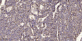 Anti-DNAH12 antibody (565-615 aa) (STJ196176) – Figure 1 of 1