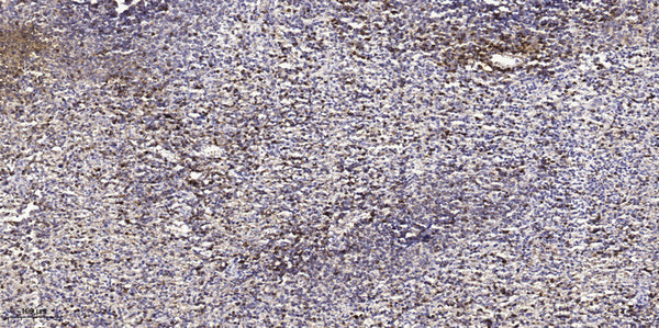 Anti-AHSP antibody (1-51 aa) (STJ196177) – Figure 1 of 1