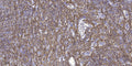 Anti-LCE3E antibody (31-81 aa) (STJ196178) – Figure 1 of 1