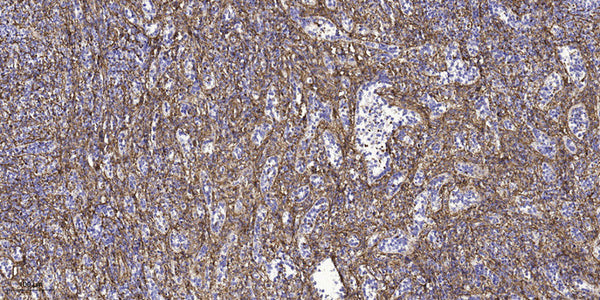 Anti-LCE3E antibody (31-81 aa) (STJ196178) – Figure 1 of 1