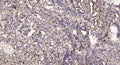 Anti-DNM1P34 antibody (6-56 aa) (STJ196180) – Figure 1 of 1