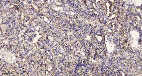 Anti-DNM1P34 antibody (6-56 aa) (STJ196180) – Figure 1 of 1