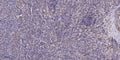 Anti-WDR87 antibody (74-124 aa) (STJ196183) – Figure 1 of 1