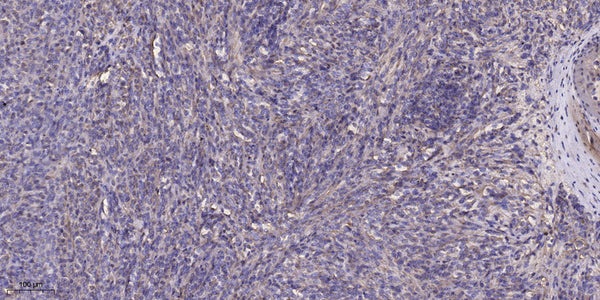 Anti-WDR87 antibody (74-124 aa) (STJ196183) – Figure 1 of 1