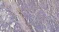 Anti-MORN2 antibody (25-75 aa) (STJ196191) – Figure 1 of 1
