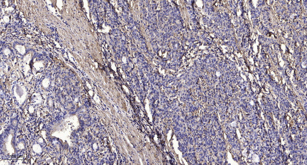 Anti-MORN2 antibody (25-75 aa) (STJ196191) – Figure 1 of 1