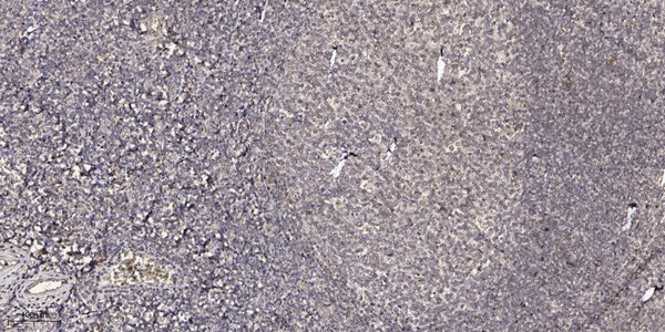Anti-GPR15LG antibody (19-69 aa) (STJ196197) – Figure 1 of 1