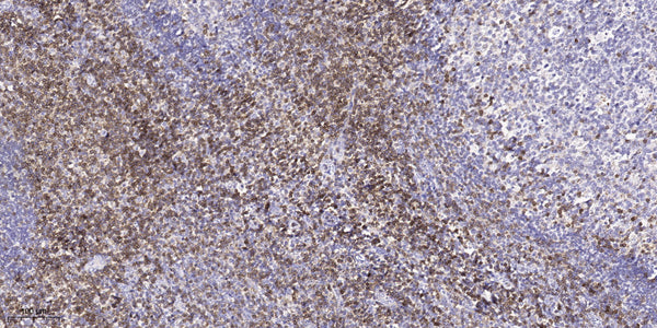 Anti-FLNC antibody (335-385 aa) (STJ196198) – Figure 1 of 1