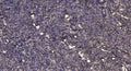 Anti-DAPL1 antibody (49-99 aa) (STJ196199) – Figure 1 of 1