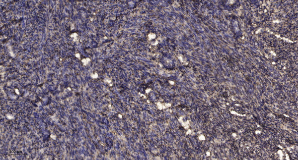 Anti-DAPL1 antibody (49-99 aa) (STJ196199) – Figure 1 of 1