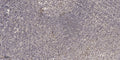 Anti-BAGE antibody (1-24 aa) (STJ196203) – Figure 1 of 1