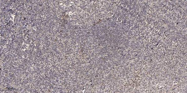 Anti-BAGE antibody (1-24 aa) (STJ196203) – Figure 1 of 1