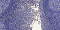 Anti-FAM167A-AS1 antibody (15-65 aa) (STJ196207) – Figure 1 of 1