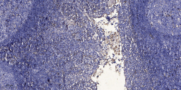 Anti-FAM167A-AS1 antibody (15-65 aa) (STJ196207) – Figure 1 of 1