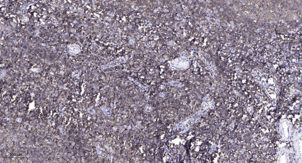 Anti-DSP antibody (1546-1596 aa) (STJ196213) – Figure 1 of 1
