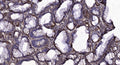Anti-HIGD1C antibody (29-79 aa) (STJ196215) – Figure 1 of 1