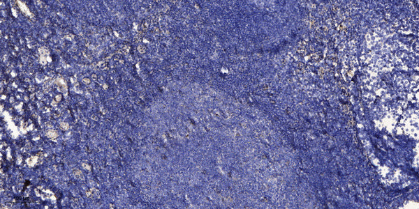 Anti-LINC01587 antibody (6-56 aa) (STJ196217) – Figure 1 of 1