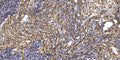 Anti-DNAH5 antibody (2445-2495 aa) (STJ196218) – Figure 1 of 1