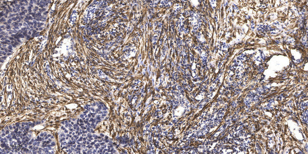 Anti-DNAH5 antibody (2445-2495 aa) (STJ196218) – Figure 1 of 1
