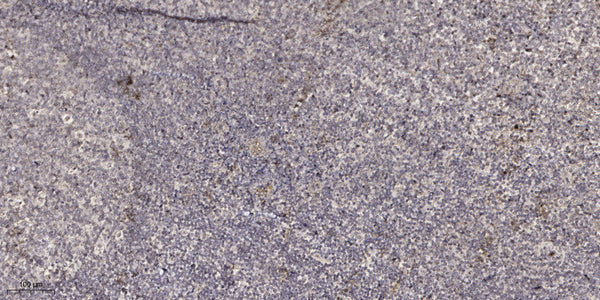 Anti-NICOL1 antibody (24-74 aa) (STJ196219) – Figure 1 of 1