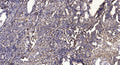 Anti-KRTAP8-1 antibody (13-63 aa) (STJ196220) – Figure 1 of 1