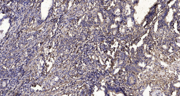 Anti-KRTAP8-1 antibody (13-63 aa) (STJ196220) – Figure 1 of 1