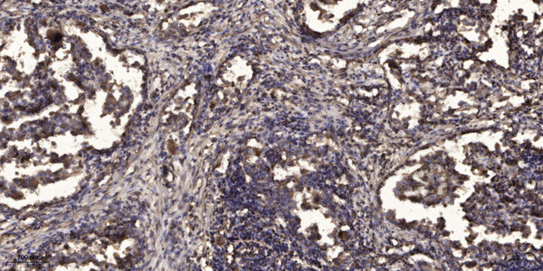 Anti-TMEM14A antibody (6-56 aa) (STJ196223) – Figure 1 of 1